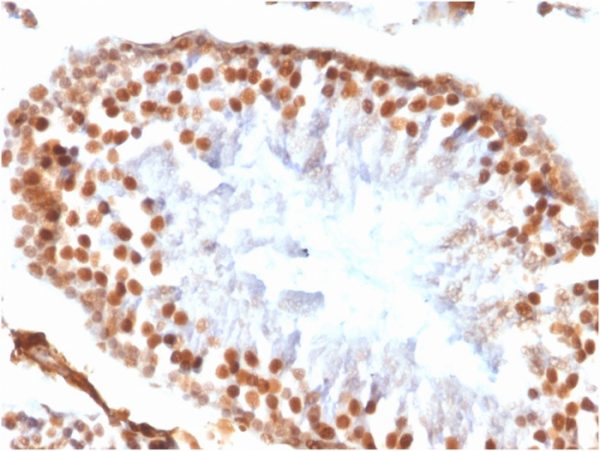 Formalin-fixed, paraffin-embedded rat testis stained with Wilm&apos;s Tumor Rabbit Recombinant Monoclonal Antibody (WT1/1434R).