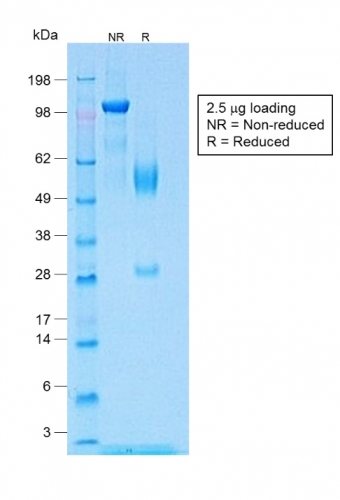 SDS-PAGE Analysis Purified Wilm&apos;s Tumor Rabbit Recombinant Monoclonal (WT1/1434R). Confirmation of Purity and Integrity of Antibody.