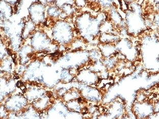 FFPE human kidney. Wilm&apos;s Tumor 1 labeled using WT1/3477R (1ug/ml). HIER: Tris/EDTA (pH9.0). HRP-Polymer. Hematoxylin counterstain.