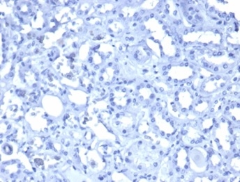 FFPE human kidney. PBS instead of primary antibody. Secondary antibody only negative control. Hematoxylin counterstain.