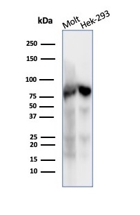 Western blot analysis of MOLT-4 and HEK293 cell lysates using XRCC5 / Ku86 / Ku80 Mouse Monoclonal Antibody (XRCC5/7317). XRCC5 (Ku86 / Ku80) (Thyroid-Lupus Autoantigen) Antibody - Image 3