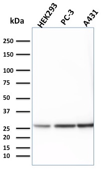 Western Blot Analysis of HEK293, PC-3 and A431 cell lysates using 14-3-3E Mouse Monoclonal Antibody (CPTC-YWHAE-1).
