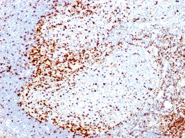 Formalin-fixed, paraffin-embedded human Tonsil stained with ZAP70 Mouse Monoclonal Antibody (2F3.2)
