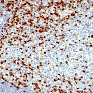 Formalin-fixed, paraffin-embedded human Tonsil stained with ZAP70 Mouse Monoclonal Antibody (SPM362).