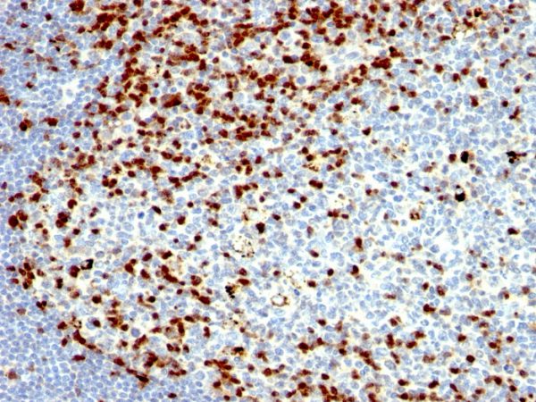 Formalin-fixed, paraffin-embedded human Tonsil stained with ZAP70 Mouse Monoclonal Antibody (SPM362).