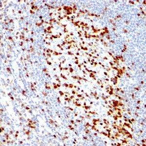 Formalin-fixed, paraffin-embedded human Tonsil stained with ZAP70 Mouse Monoclonal Antibody (ZAP70/528).