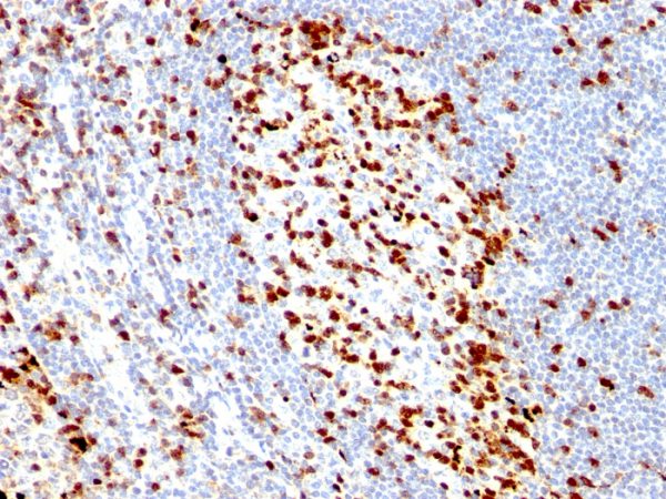 Formalin-fixed, paraffin-embedded human Tonsil stained with ZAP70 Mouse Monoclonal Antibody (ZAP70/528).