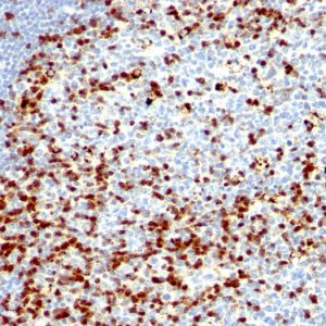 Formalin-fixed, paraffin-embedded human Tonsil stained with ZAP70 Mouse Monoclonal Antibody (ZAP70/528 + 2F3.2).