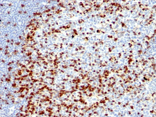 Formalin-fixed, paraffin-embedded human Tonsil stained with ZAP70 Mouse Monoclonal Antibody (ZAP70/528 + 2F3.2).