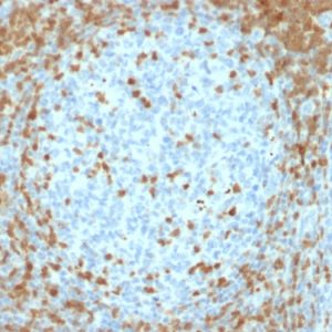 Formalin-fixed, paraffin-embedded human Tonsil stained with ZAP70 Mouse Monoclonal Antibody (ZAP70/2035).