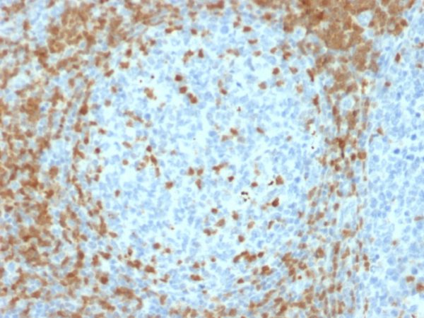 Formalin-fixed, paraffin-embedded human Tonsil stained with ZAP70 Mouse Monoclonal Antibody (ZAP70/2035).