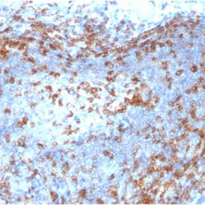 Formalin-fixed, paraffin-embedded human Lymph Node stained with ZAP70 Mouse Monoclonal Antibody (ZAP70/2046).