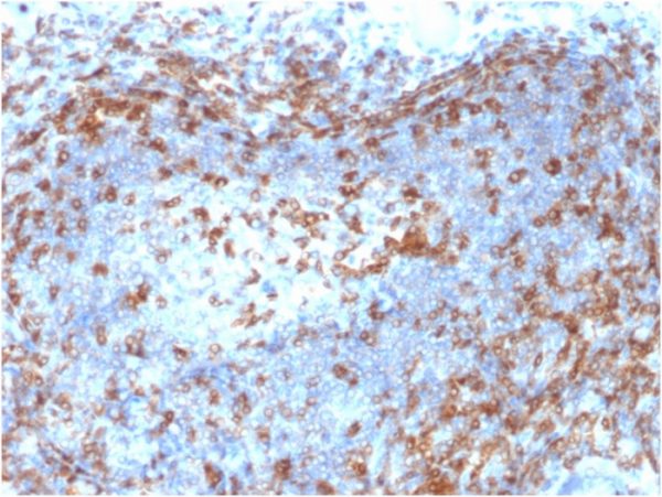 Formalin-fixed, paraffin-embedded human Lymph Node stained with ZAP70 Mouse Monoclonal Antibody (ZAP70/2046).