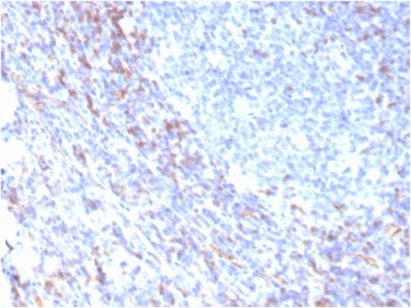 Formalin-fixed, paraffin-embedded human tonsil stained with ZAP70 Recombinant Mouse Monoclonal Antibody (rZAP70/2046).