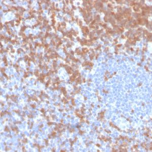 Formalin-fixed, paraffin-embedded human tonsil stained with ZAP70 Recombinant Rabbit Monoclonal Antibody (ZAP70/4040R).