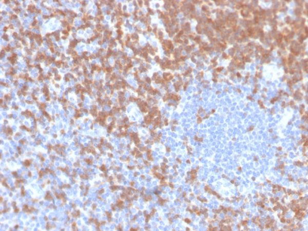 Formalin-fixed, paraffin-embedded human tonsil stained with ZAP70 Recombinant Rabbit Monoclonal Antibody (ZAP70/4040R).