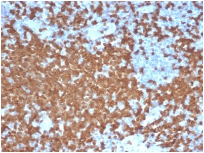 Formalin-fixed, paraffin-embedded human tonsil stained with ZAP70 Recombinant Rabbit Monoclonal Antibody (ZAP70/6492R).