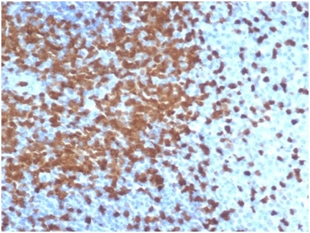 Formalin-fixed, paraffin-embedded human tonsil stained with ZAP70 Recombinant Rabbit Monoclonal Antibody (ZAP70/6492R).