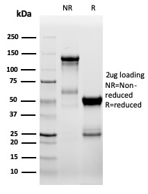 SDS-PAGE Analysis Purified ZAP70 Recombinant Rabbit Monoclonal Antibody (ZAP70/6492R). Confirmation of Purity and Integrity of Antibody.