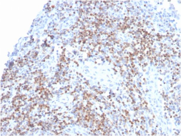 Formalin-fixed, paraffin-embedded human tonsil stained with ZAP70 Recombinant Rabbit Monoclonal Antibody (ZAP70/3921R).