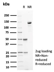 SDS-PAGE Analysis Purified CA8 Mouse Monoclonal Antibody (CA8/6572). Confirmation of Purity and Integrity of Antibody.
