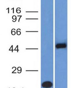 Western Blot Analysis (A) Recombinant Protein (B) Raji cell lysate Using PAX8 Monoclonal Antibody (PAX8/1491 + PAX8/1492).