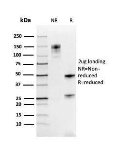 SDS-PAGE Analysis Purified PAX8 Recombinant Mouse Monoclonal Antibody (rPAX8/3687). Confirmation of Purity and Integrity of Antibody.
