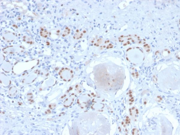 Formalin-fixed, paraffin-embedded human Kidney stained with PAX8 Recombinant Rabbit Monoclonal Antibody (PAX8/2774R).