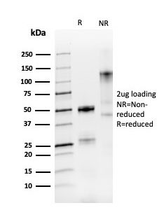 SDS-PAGE Analysis Purified PAX8 Recombinant Rabbit Monoclonal Antibody (PAX8/3688R). Confirmation of Purity and Integrity of Antibody.