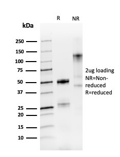 SDS-PAGE Analysis of Purified PAX8 Recombinant Rabbit Monoclonal Antibody (PAX8/3688R). Confirmation of Purity and Integrity of Antibody.