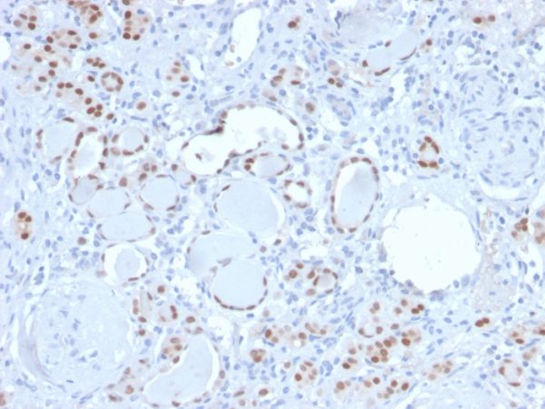 Formalin-fixed, paraffin-embedded human kidney stained with PAX8 Recombinant Rabbit Monoclonal Antibody (PAX8/3688R).