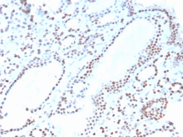 Formalin-fixed, paraffin-embedded human thyroid stained with PAX8 Recombinant Rabbit Monoclonal Antibody (ZR-1).