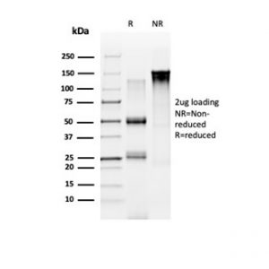 SDS-PAGE Analysis of Purified NOC4L Mouse Monoclonal Antibody (PCRP-NOC4L-1B2). Confirmation of Integrity and Purity of Antibody.