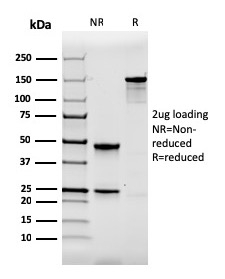 SDS-PAGE Analysis of Purified Calbindin 1 Mouse Monoclonal Antibody (CALB1/2364). Confirmation of Integrity and Purity of Antibody.