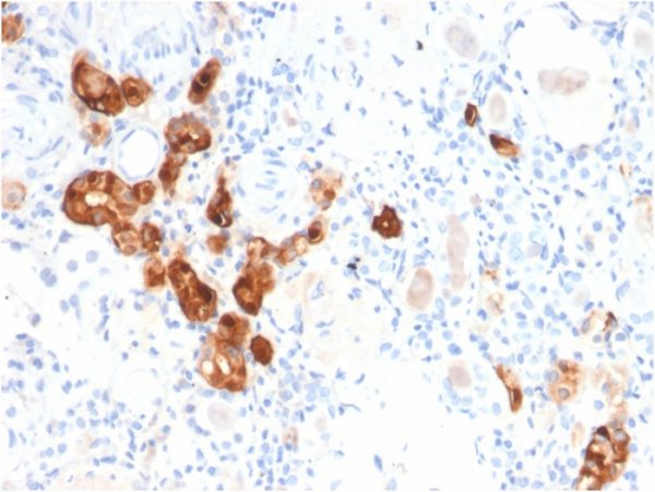 Formalin-fixed, paraffin-embedded human Kidney stained with Calbindin 1 Mouse Monoclonal Antibody (CALB1/2782).