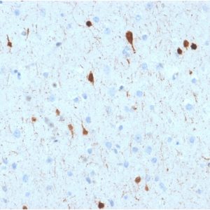 Formalin-fixed, paraffin-embedded human Cerebellum stained with Calretinin Mouse Monoclonal Antibody (CALB2/2602).