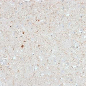 Formalin-fixed, paraffin-embedded human Cerebellum stained with Calretinin Mouse Monoclonal Antibody (CALB2/2603).