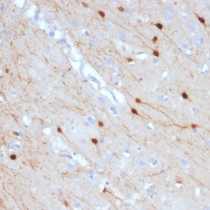 Formalin-fixed, paraffin-embedded human Cerebellum stained with Calretinin Mouse Monoclonal Antibody (CALB2/2685).