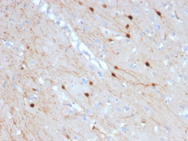 Formalin-fixed, paraffin-embedded human Cerebellum stained with Calretinin Mouse Monoclonal Antibody (CALB2/2685).