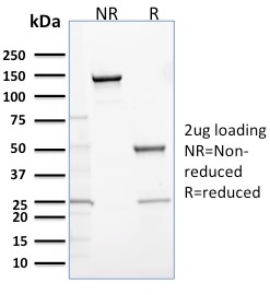 SDS-PAGE Analysis Purified Calretinin Mouse Monoclonal Antibody (CALB2/2685). Confirmation of Purity and Integrity of Antibody.