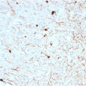 Formalin-fixed, paraffin-embedded human Cerebellum stained with Calretinin Mouse Monoclonal Antibody (CALB2/2786).