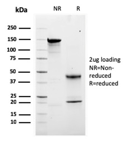 SDS-PAGE Analysis Purified Calretinin Mouse Monoclonal Antibody (CALB2/2807). Confirmation of Purity and Integrity of Antibody.