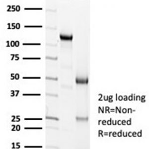 SDS-PAGE Analysis of Purified Calretinin Recombinant Rabbit Monoclonal Antibody (CALB2/7029R). Confirmation of Purity and Integrity of Antibody.