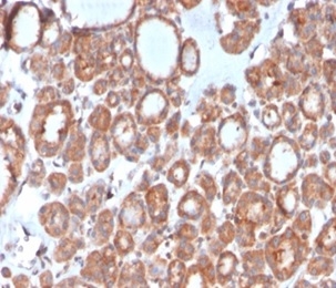 Formalin-fixed, paraffin-embedded human thyroid stained with  Calcitonin Mouse Monoclonal Antibody (CALCA/3310). HIER: Tris/EDTA, pH9.0, 45min. 2 °: HRP-polymer, 30min. DAB, 5min.
