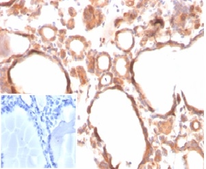 Formalin-fixed, paraffin-embedded human thyroid stained with  Calcitonin Mouse Monoclonal Antibody (CALCA/3310). Inset: PBS instead of primary antibody; secondary only negative control.