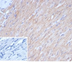 Formalin-fixed, paraffin-embedded human smooth muscle stained with h-CALD Recombinant Mouse Monoclonal Antibody (rCALD1/7266). Inset: PBS instead of primary antibody; secondary only negative control.