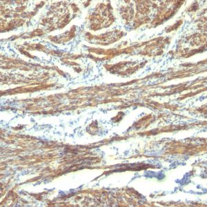 Formalin-fixed, paraffin-embedded human Uterus stained with Caldesmon Monoclonal Antibody (CALD1/820 + h-CALD).