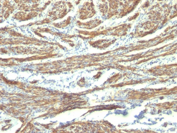 Formalin-fixed, paraffin-embedded human Uterus stained with Caldesmon Monoclonal Antibody (CALD1/820 + h-CALD).