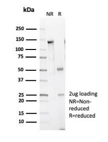SDS-PAGE Analysis Purified h-CALD Rabbit Recombinant Monoclonal Antibody (CALD1/7024R). Confirmation of Integrity and Purity of Antibody.
