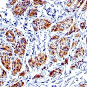 Formalin-fixed, paraffin-embedded human Uterus stained with Caldesmon Rabbit Recombinant Monoclonal Antibody (CALD1/1424R).